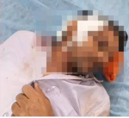 इटावा में दबंगों का कहर, पुरानी रंजिश में फावड़े से हमला कर युवक को किया गंभीर घायल
